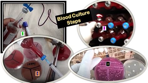 Blood Culture: Introduction, Test Requirements, Procedure, Result-Interp