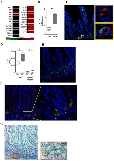 IL 1β production by Paneth cells precedes the IFN antiviral response in