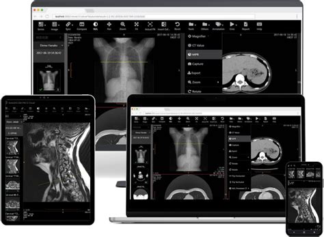 instantly access  analyze medical images meet  game changing