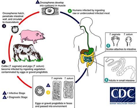 Taeniasis causes, symptoms, diagnosis & treatment