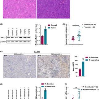 Effects Of RAD21 On Hepatocellular Carcinoma HCC Cell Sensitivity To