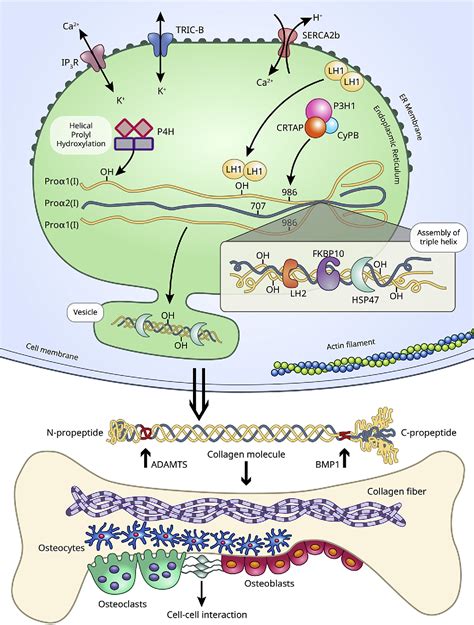 Figure From Osteogenesis Imperfecta New Genes Reveal Novel