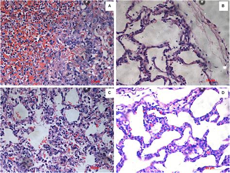 Frontiers Outer Membrane Lipoprotein Lip Modulates Adherence