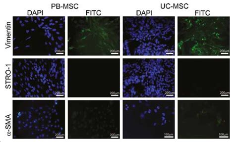 Immunofluorescent Labeling Of Pb Mscs And Uc Mscs Representative Download Scientific Diagram