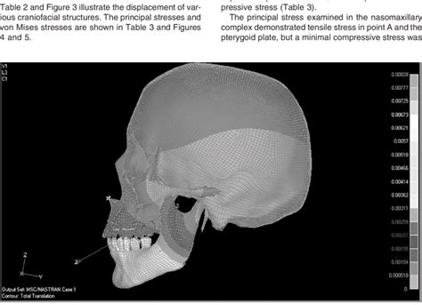 Displacement Pattern In Mm Of Craniofacial Structures A With Fixed