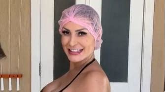 Andressa Urach faz novo procedimento estético e comemora Cara de rica