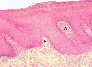 Hard Palate Histology