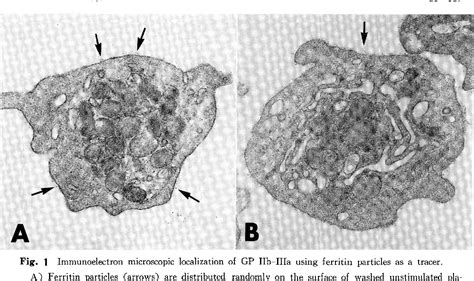 Figure 1 From Immunoelectron Microscopic Study Of Fibrinogen Binding