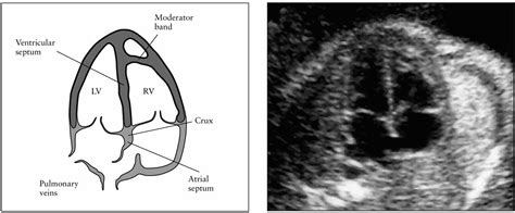 Cardiac Screening Examination Of The Fetus Guidelines For Performing The ‘basic’ And ‘extended