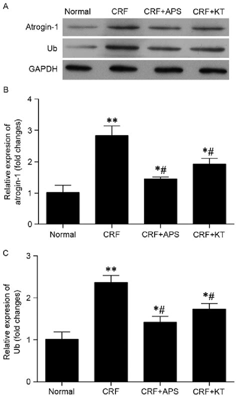 Aps Decreased The Mrna And Protein Expression Of Atrogin And Ub In