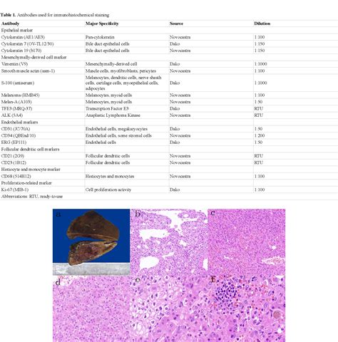 Table 1 From Hepatic Epithelioid Angiomyolipoma With Prominent Invasive