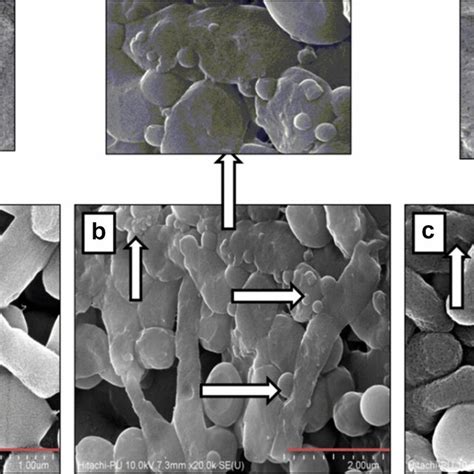 Sem Images Of Untreated And Peptide Treated E Coli Atcc Cells