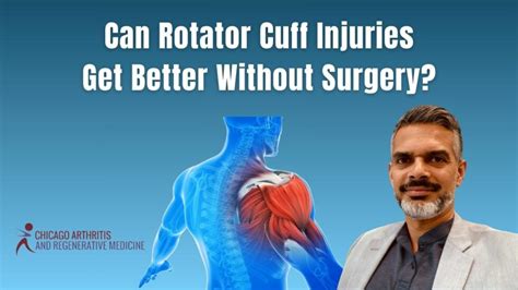 Alternatives To Rotator Cuff Surgery Archives Chicago Arthritis And