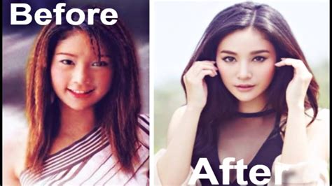 Thai Actresses Before And After Plastic Surgery Thai Celebrity Fever Youtube