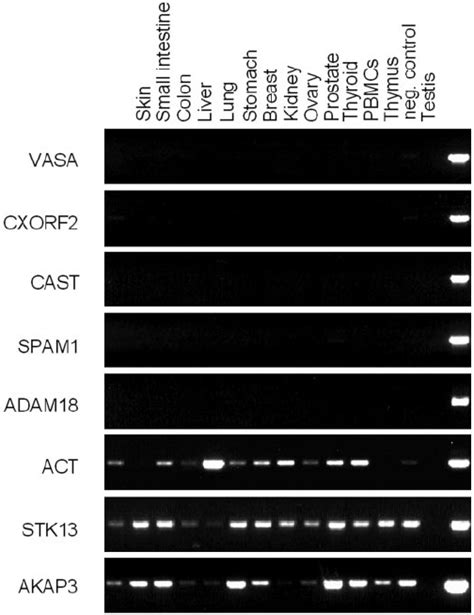 Strategy For The Identification Of Germ Cell Specific Genes Data