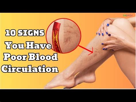 Common Signs You Have Poor Blood Circulation Without Even Knowing It