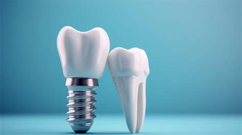 How Long Do Dental Implants Last Expert Insights On Their Longevity