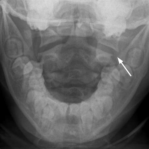 Do Additional Views Improve The Diagnostic Performance Of Cervical