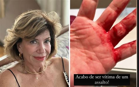 Apresentadora Silvia Poppovic é vítima de assalto em São Paulo Quase