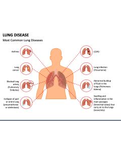 Bacterial Diseases Powerpoint And Google Slides Template Ppt Slides