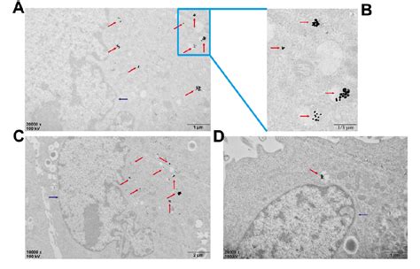 Figure 5 From High Discrimination Factor Nanosensor Based On Tetrahedral Dna Nanostructures And