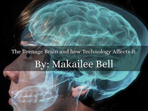 The Teenage Brain And How Technology Affects It By