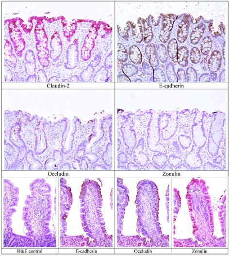 Tight Junction Protein Tjp Expression In Intestinal Epithelia Of