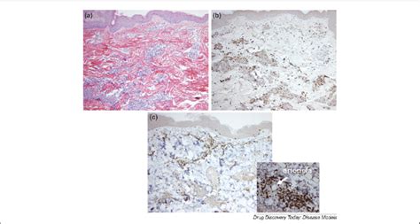 Representative Examples Of Histological Changes Observed In Skin