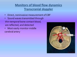 cerebral monitoring