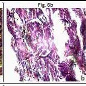 A A Photomicrograph Of Transverse Section In The Control Rat Liver