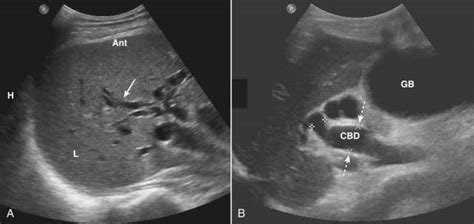 Ultrasonography Radiology Key