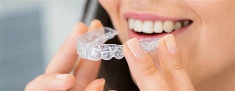 5 Factors To Consider When Choosing An Invisalign Doctor Insoft