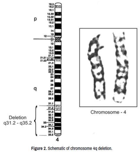 molecular-genetic-medicine-deletion