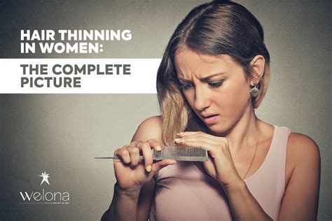 Hair Thinning in Women: Causes & Symptoms - The Complete Picture