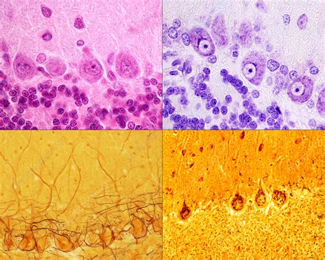 Purkinje Cells Histology