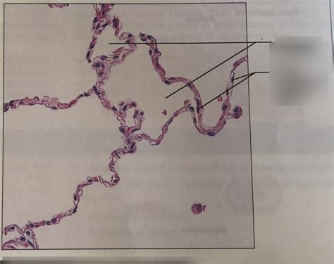 Simple Squamous Epithelium Diagram Quizlet