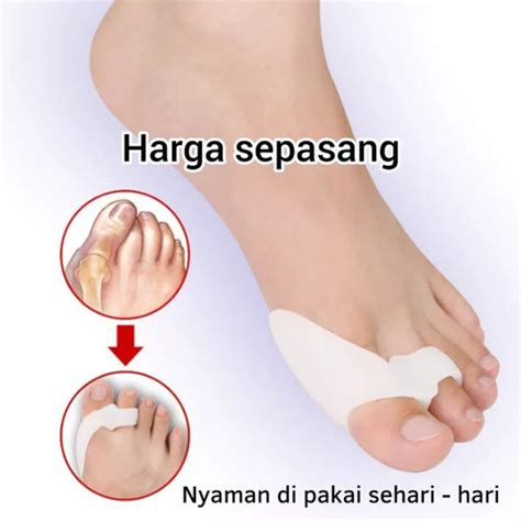 Promo ALAT KOREKTOR JEMPOL JARI KAKI PELURUS CORRECTOR BUNION HALLUX