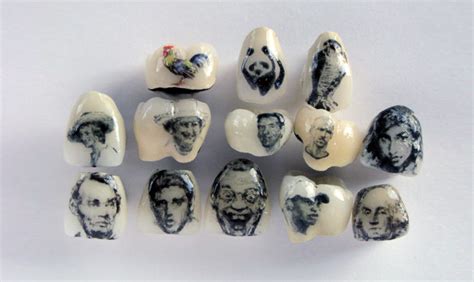 Татуировки на зубах (dental tattoo): что такое, как выглядит и ...