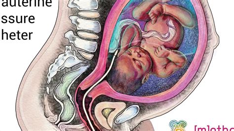 Internal Monitoring Explained: Intrauterine Pressure Cath, 59% OFF