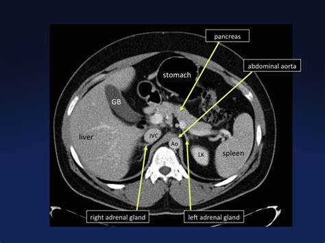 Cross Sectional Anatomy Of The Body Mdct Atlas Ct Scanning