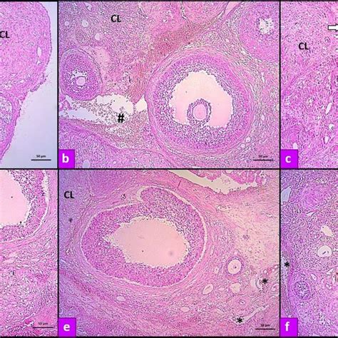 Photomicrographs Of Ovarian Sections Demonstrated By Hematoxylin And