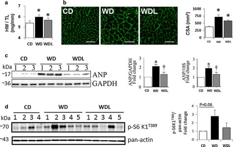 Linagliptin Inhibits WD Induced Cardiac Hypertrophy And Induction Of