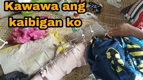 Nabali Ang Kanang Paa Ng Kaibigan Ko Dinalhan Ko Ng Kunting Tulong