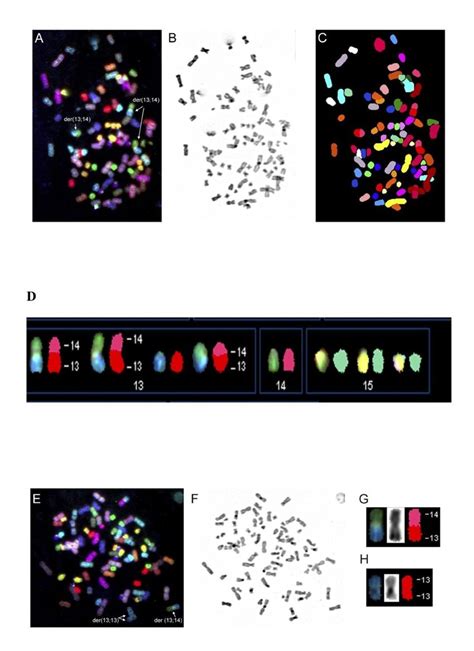 Cytogenetic Characterization Representative Karyotype From SKY Analysis