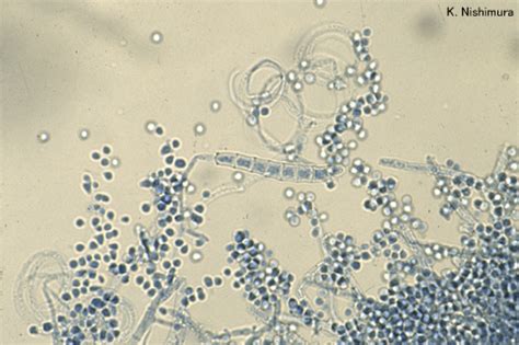 Trichophyton mentagrophytes micro