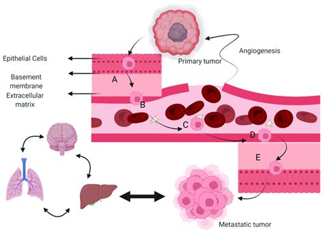 Various Involved Steps In Metastasis A Local Invasion B Download Scientific Diagram