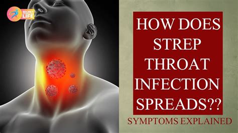 How Do You Get Strep Throat Throat Vs Oral Gonorrhea Secret To