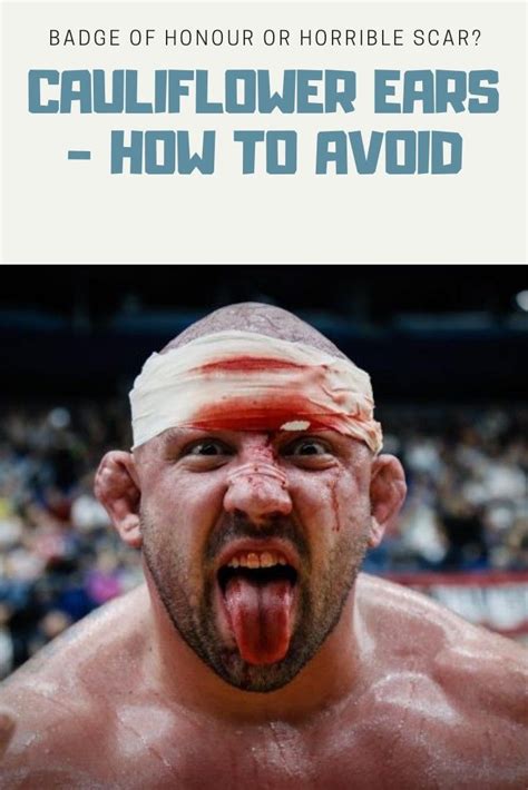 How To Give Yourself Cauliflower Ear Howtonc