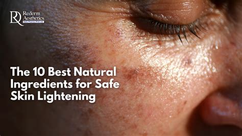 The 10 Best Natural Ingredients For Safe Skin Lightening Redermaesthetics