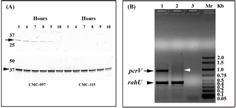 Comparative Transcriptomic Analysis Of Pseudomonas Aeruginosa Isolates From Icu Patients With